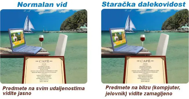 staračka dalekovidost
