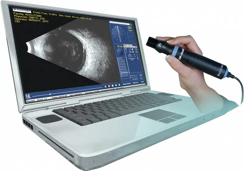 Ultrazvučna dijagnostika-laptop